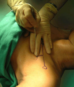 ortopaedic-surgery